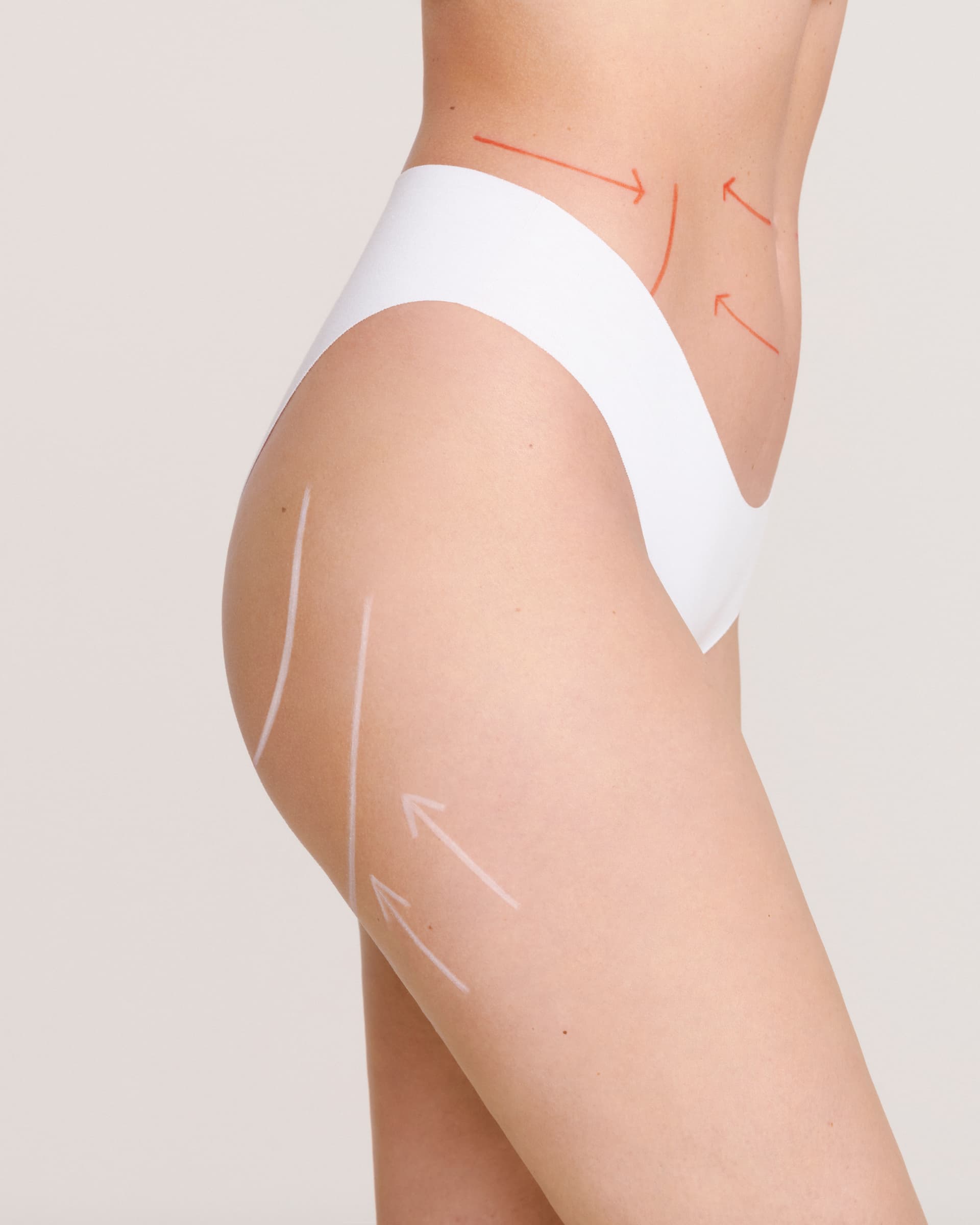 Acido ialuronico ai Glutei: quanto costa? Prezzi e Informazioni